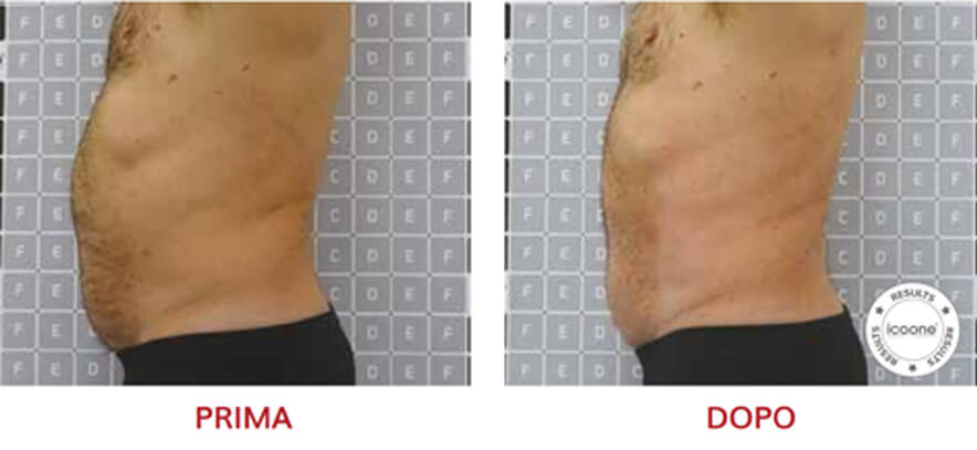 ICOONE Result