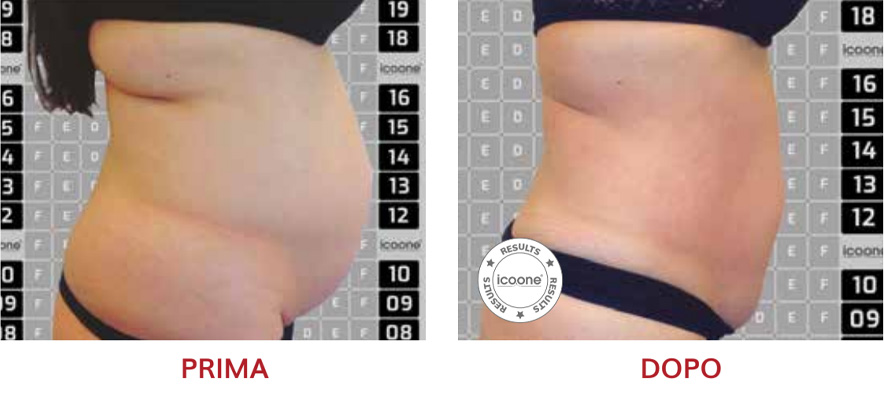 ICOONE Result