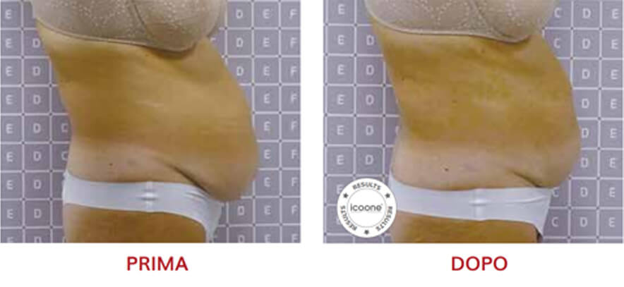ICOONE Result