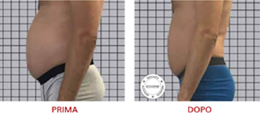 ICOONE Result