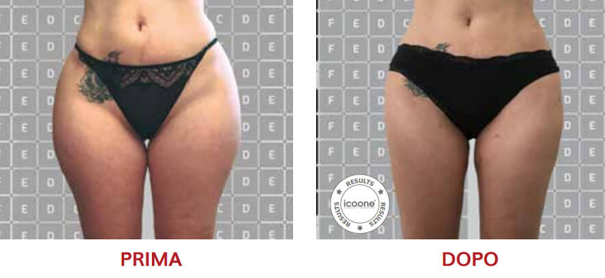 ICOONE Result