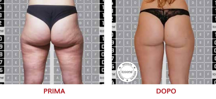 ICOONE Result
