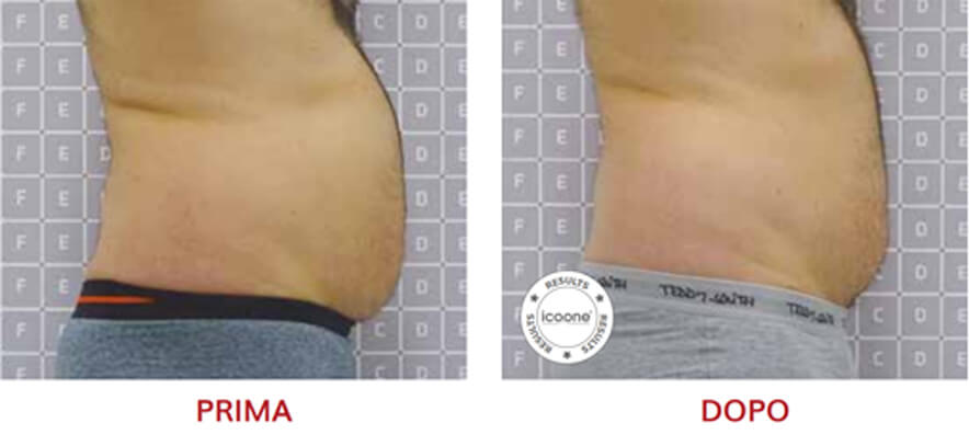 ICOONE Result